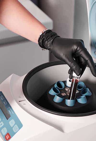 gabari_0002_researcher-putting-test-tube-into-laboratory-centrifuge